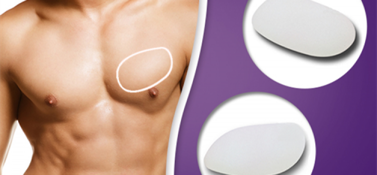 Saiba mais sobre a Cirurgia de Implante Peitoral Masculino_Servimedic Technology